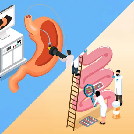 Gasztroszkópia és kolonoszkópia egyidejűleg