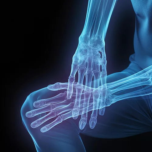 Csont- és ízületi laborcsomag